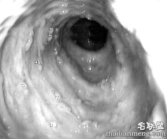 实用贴!怎样清理宿便?这10个办法都排干净