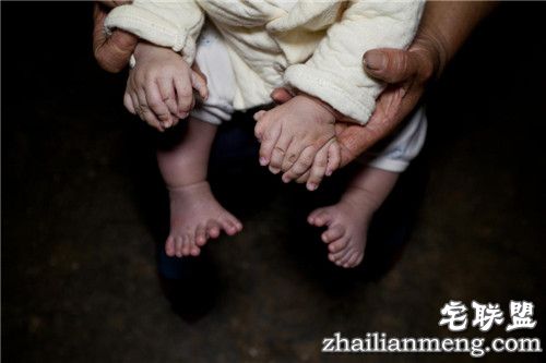 3个月大男婴患"多指症" 手指脚趾总共31根 惊呆了 3个月大男婴患"多指症" 手指脚趾总共31根 惊呆了