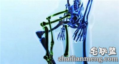 奇迹!畸形男:活着就能改变全球 奇迹!畸形男:活着就能改变全球