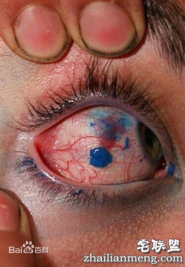 变态尝试,纹眼球 网友:真是大开眼 变态尝试,纹眼球 网友:真是大开眼