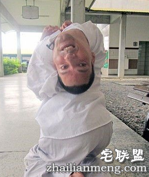 奇迹!畸形男:活着就能改变全球 奇迹!畸形男:活着就能改变全球