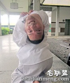 奇迹!畸形男:活着就能改变全球 奇迹!畸形男:活着就能改变全球