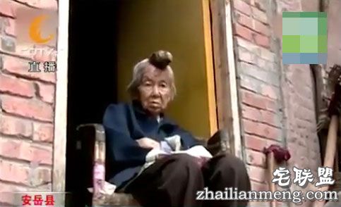87岁老太头上长出13cm长“独角”让人称奇 87岁老太头上长出13cm长“独角”让人称奇