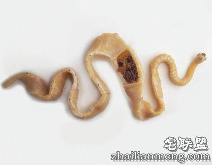 女子吃带血丝牛排 体内竟长出2.5米长绦虫! 女子吃带血丝牛排 体内竟长出2.5米长绦虫!