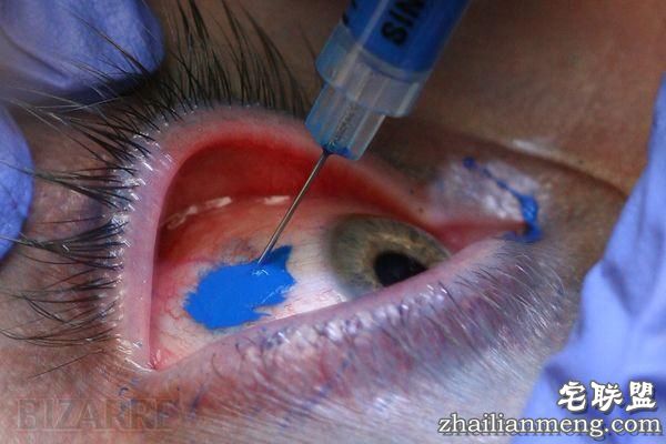 变态尝试,纹眼球 网友:真是大开眼 变态尝试,纹眼球 网友:真是大开眼