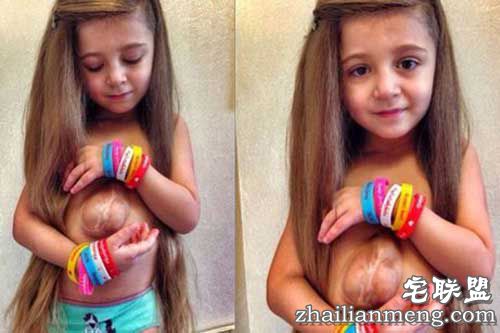 俄罗斯女孩天生心脏长在胸腔外 被称"天使之心" 俄罗斯女孩天生心脏长在胸腔外 被称"天使之心"