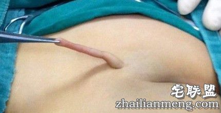 吓尿!幼童屁股长出尾巴 换尿不湿要提起小尾巴! 吓尿!幼童屁股长出尾巴 换尿不湿要提起小尾巴!