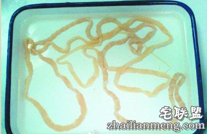 女子吃带血丝牛排 体内竟长出2.5米长绦虫! 女子吃带血丝牛排 体内竟长出2.5米长绦虫!