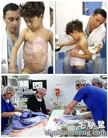 哥伦比亚8岁男孩患怪病背似龟壳 半人半龟惊悚像怪兽! 哥伦比亚8岁男孩患怪病背似龟壳 半人半龟惊悚像怪兽!