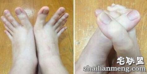 女大学生脚趾修长如手指 可以轻松用脚趾写字 女大学生脚趾修长如手指 可以轻松用脚趾写字