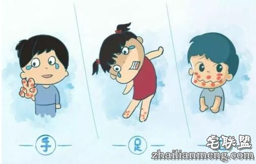 香港爆发手足口病 手足口病初期症状及预防 香港爆发手足口病 手足口病初期症状及预防