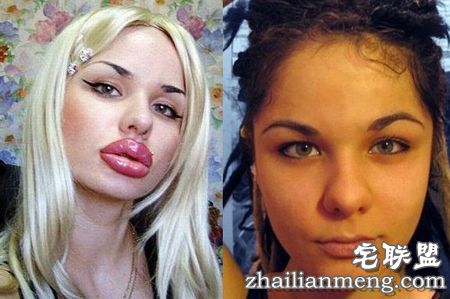 尴尬!男子把女友吻成香肠嘴网友:谁让你们秀恩爱 尴尬!男子把女友吻成香肠嘴网友:谁让你们秀恩爱