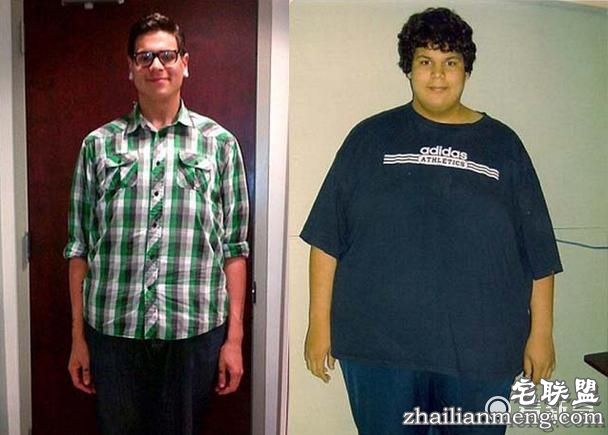 226公斤小伙猛减122公斤赘肉,但减肥成功后却不敢脱下衣服