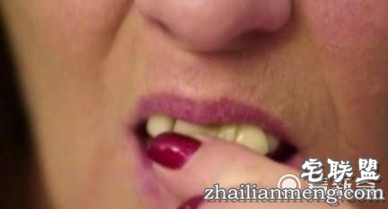 女子害怕看牙医,牙掉了用502胶水粘住,医牙竟把全副身家搭进