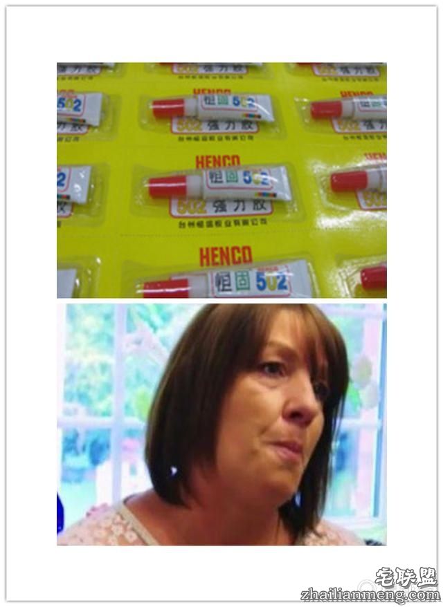 女子害怕看牙医,牙掉了用502胶水粘住,医牙竟把全副身家搭进