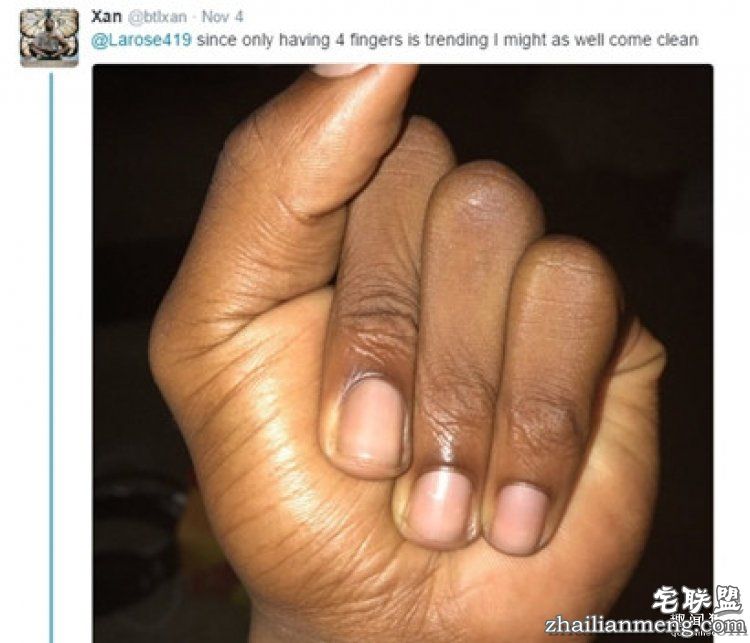 大家以为她天生4根手指,真相让这个手势一夜流行