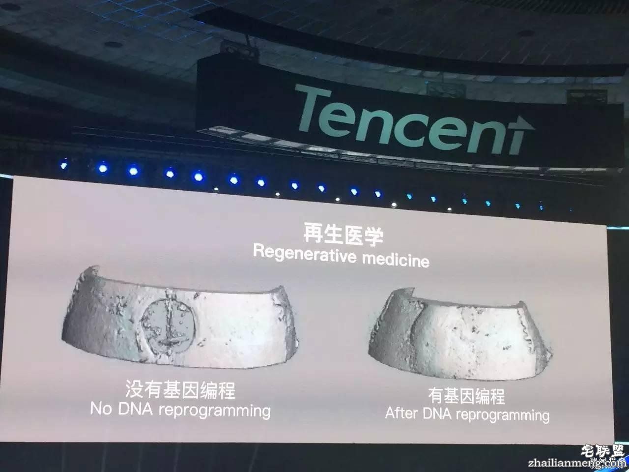 返老还童将成真,斯坦福教授解说