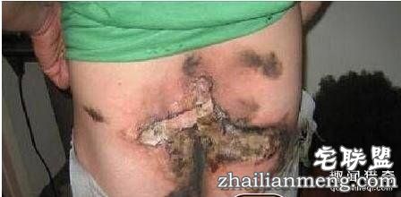 天天放屁,你却不知道的10个“屁知识”!