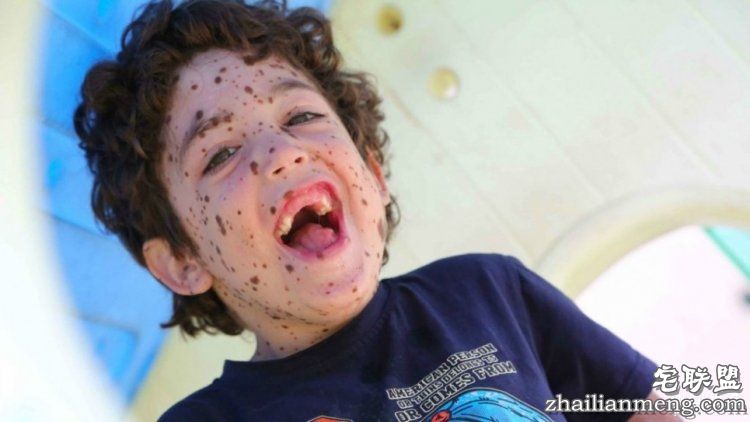 8岁男孩脸上长满胎记被嘲笑,网友的反应好有爱