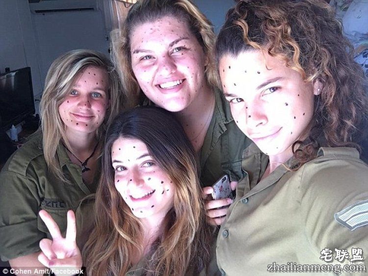 8岁男孩脸上长满胎记被嘲笑,网友的反应好有爱