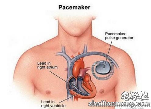 世界科学史上十大“最意外的发明”