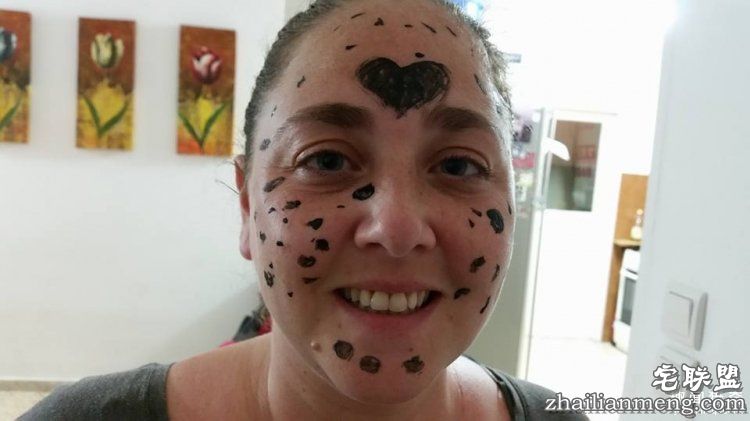 8岁男孩脸上长满胎记被嘲笑,网友的反应好有爱