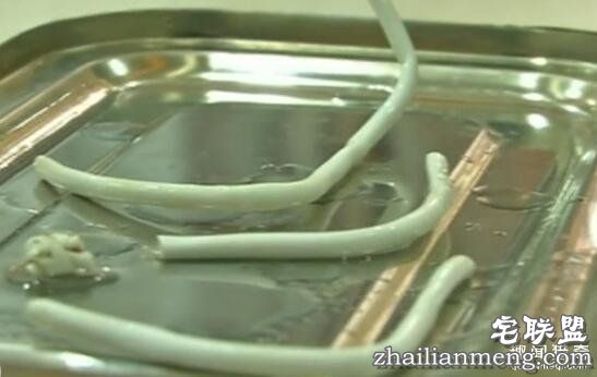 小伙看视频寻求刺激 将20cm数据线塞进尿道