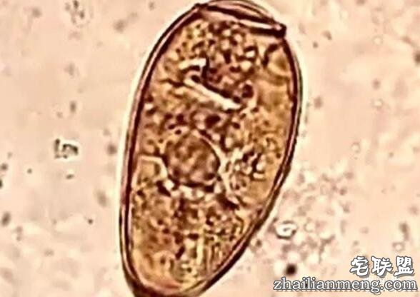 惊悚!2男童吃螃蟹 肺脑遭寄生虫吃光