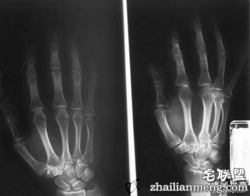 世界科学史上十大“最意外的发明”