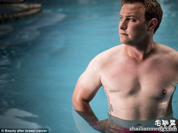 她花3年为乳腺癌幸存者拍下照片,有男人有女人