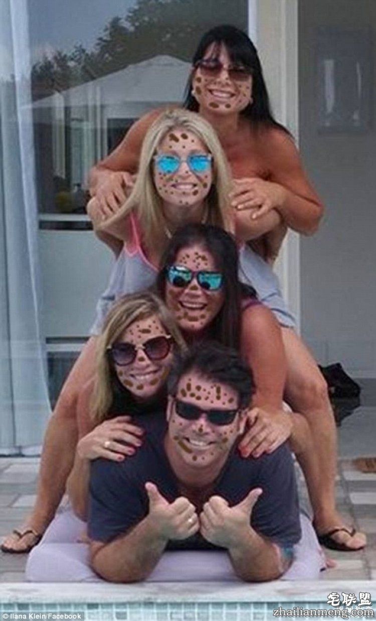 8岁男孩脸上长满胎记被嘲笑,网友的反应好有爱