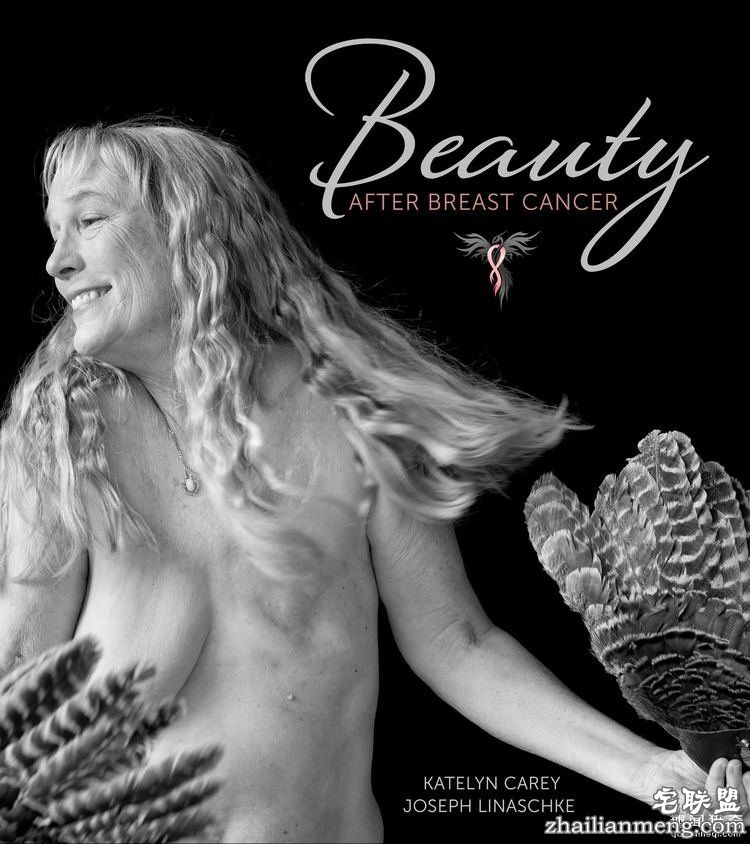 她花3年为乳腺癌幸存者拍下照片,有男人有女人