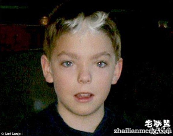 20岁小伙众筹22万变性:术后照片惊艳