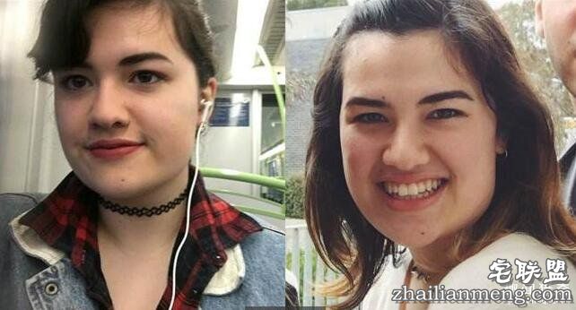 18岁少女坚持要绝育 原因是:生小孩会危害环境