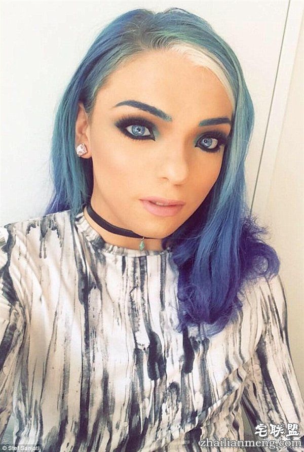 20岁小伙众筹22万变性:术后照片惊艳