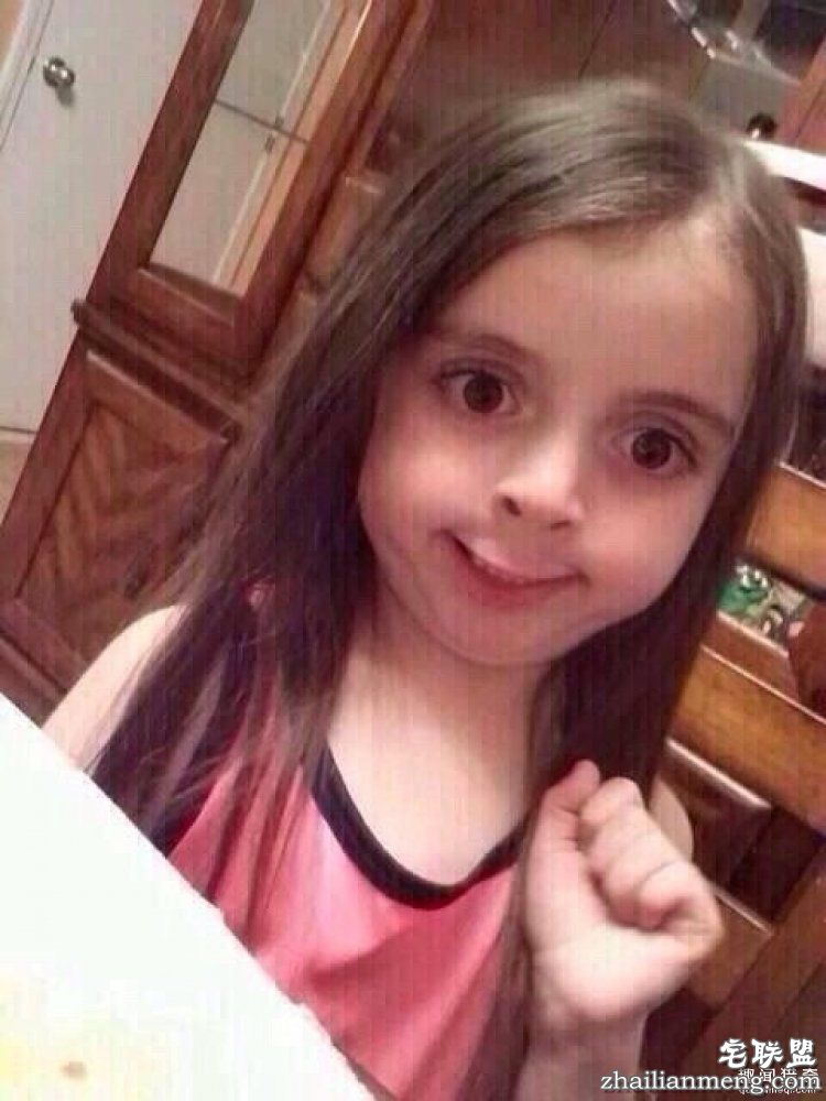 被吸尘器打断,被医生掰折…18位网友分享他们奇葩的骨折原因