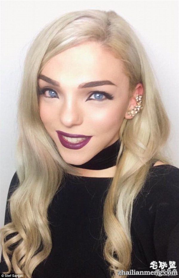 20岁小伙众筹22万变性:术后照片惊艳