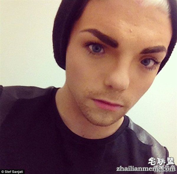 20岁小伙众筹22万变性:术后照片惊艳