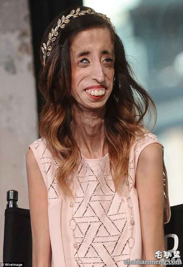 丽兹(Lizzie Velasquez)
