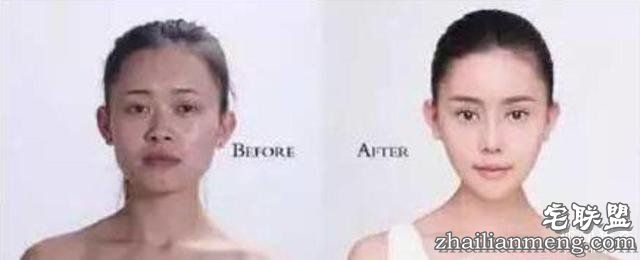 女孩花百万变身“重庆版Angelababy”,整容前后对比,惊呆了!!!