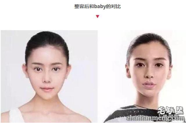 女孩花百万变身“重庆版Angelababy”,整容前后对比,惊呆了!!!