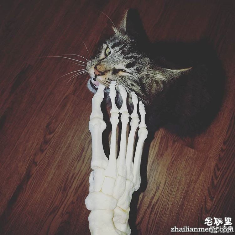 女孩被截肢后,天天拿着自己的脚骨自拍