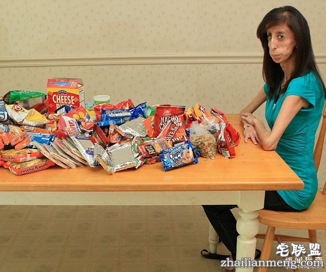 丽兹(Lizzie Velasquez)的进食日常