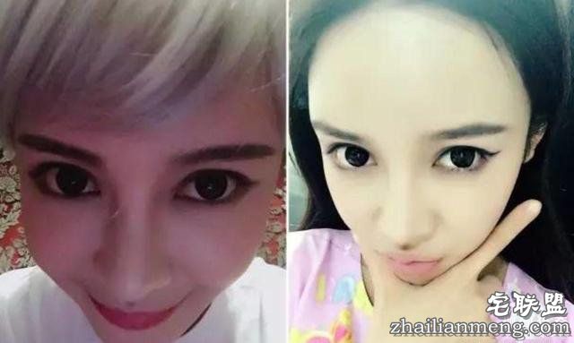 女孩花百万变身“重庆版Angelababy”,整容前后对比,惊呆了!!!