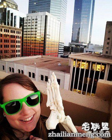 女孩被截肢后,天天拿着自己的脚骨自拍