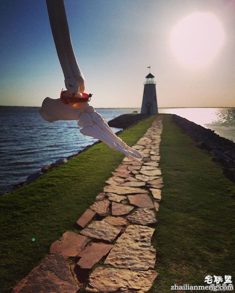 女孩被截肢后,天天拿着自己的脚骨自拍