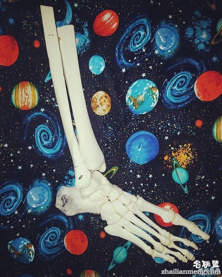 女孩被截肢后,天天拿着自己的脚骨自拍