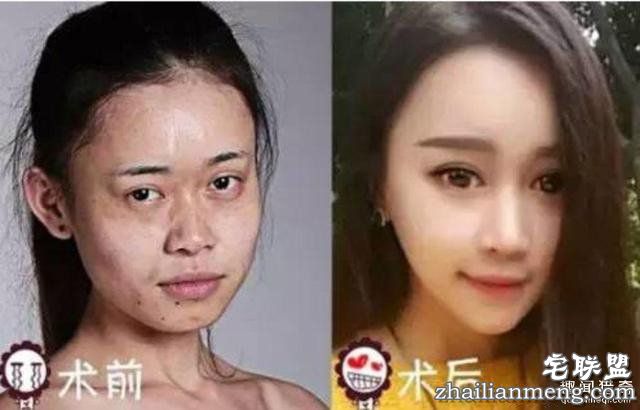女孩花百万变身“重庆版Angelababy”,整容前后对比,惊呆了!!!