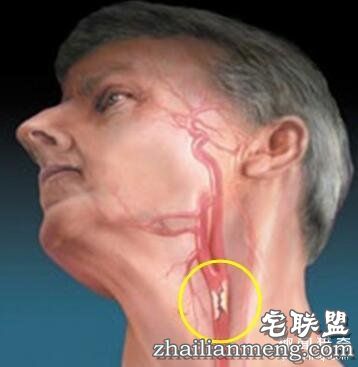 身体有6个“死穴”,伤到它们很危险!