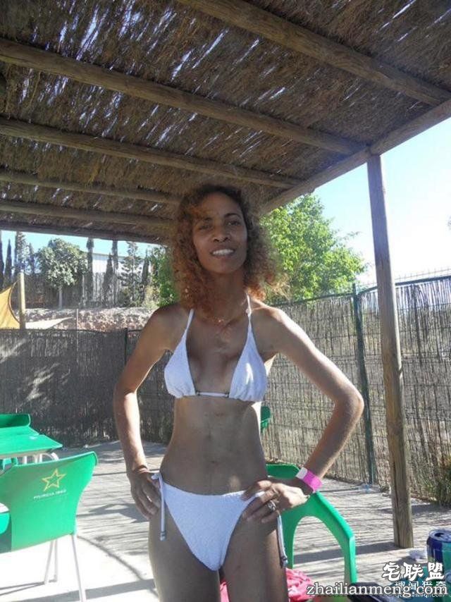 英国女子多年不孕,原来是双阴道双子宫,夫妻俩没找对地方